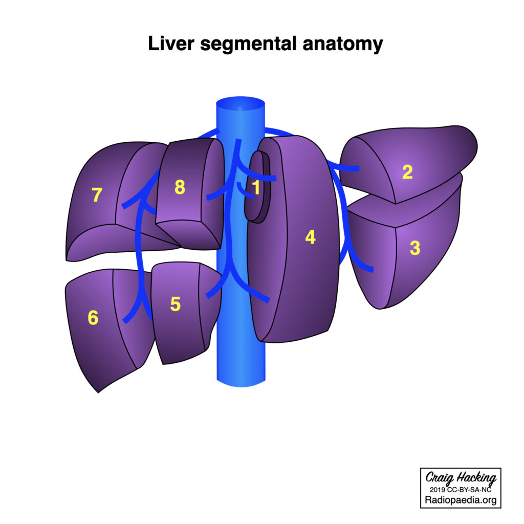 hepatectomy and sectionectomy diagram
